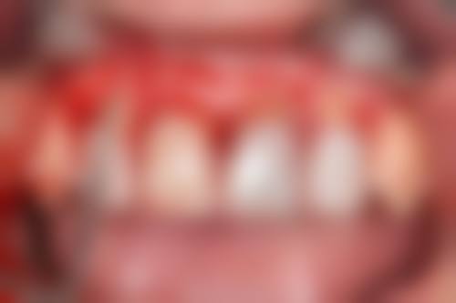 五、亚峰整形美容连锁价格表