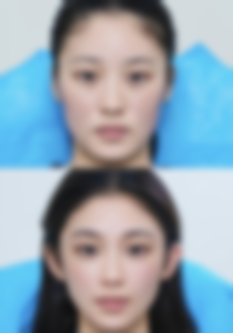 四、广州圣心微美医疗美容门诊部特色项目