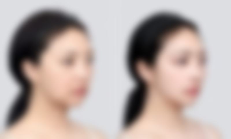 五、淄博水一方医疗美容诊所价格表