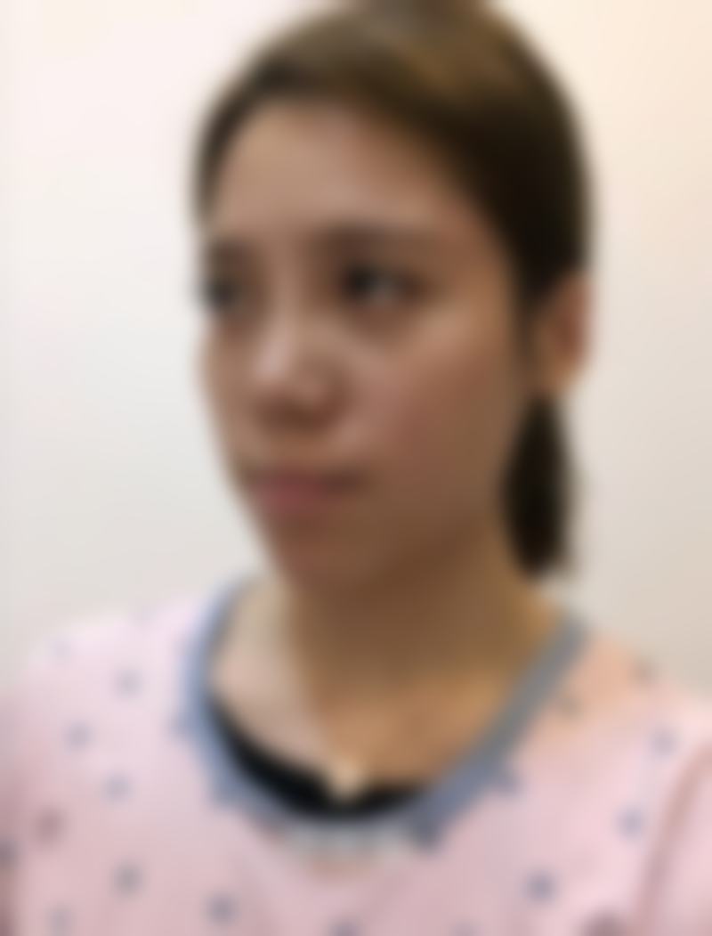 四、超声炮体验过程