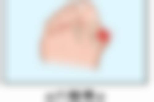 五、纳文 库马尔辛格怎么预约？