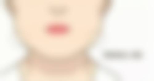 二、去痣疤痕掉了洗脸的注意事项