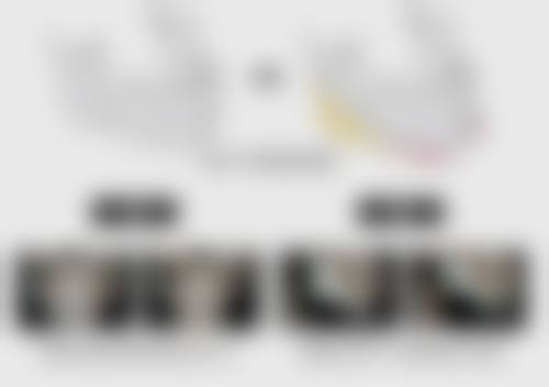 四、凹陷红色疤痕的修复阶段及方法