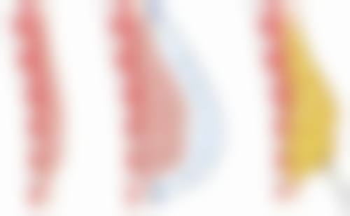 三、纳文 库马尔辛格技术优势