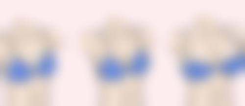 一、认识疤痕疙瘩