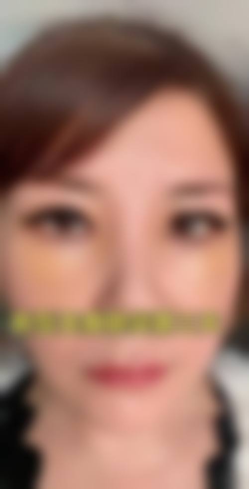 七、成都伊馨美尔医疗美容门诊部预约方式