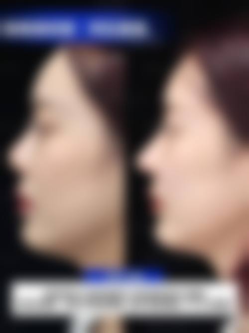 四、乐山西婵钧阁整形医学美容医院特色项目