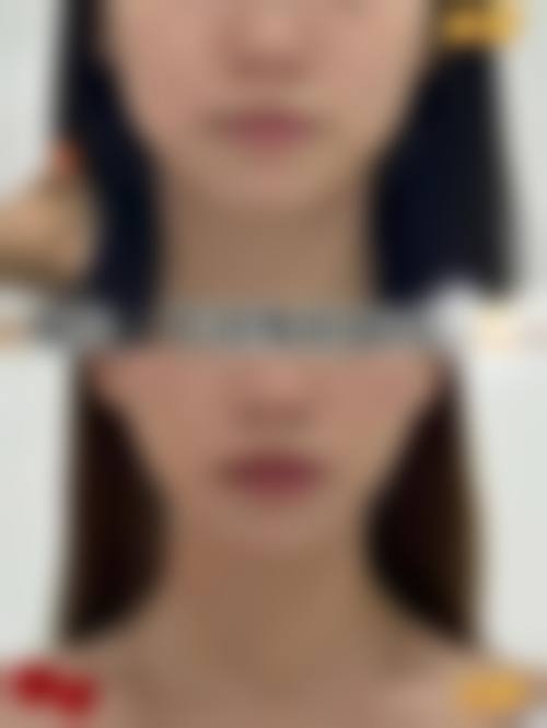 九、西安诺颜整形医疗美容医院真实的患者评价