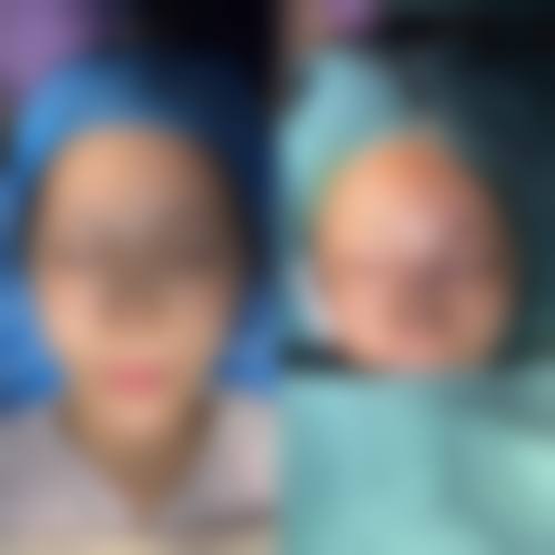 五、保定新面孔医疗美容诊所价格表