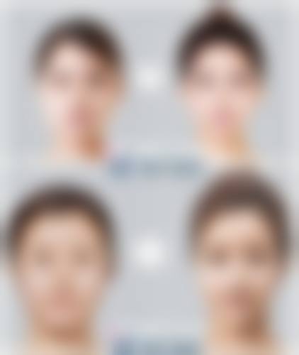 八、唐山安美医疗美容诊所真实的患者评价