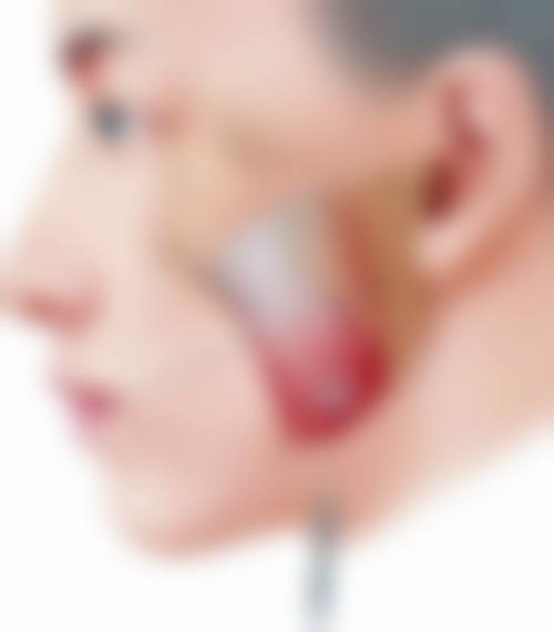 四、贵阳利美康整形(金阳院)特色项目