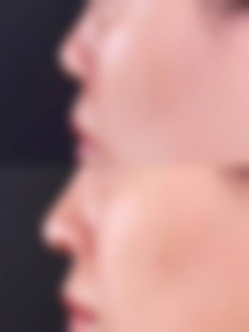 二、保定新面孔医疗美容诊所怎么样？