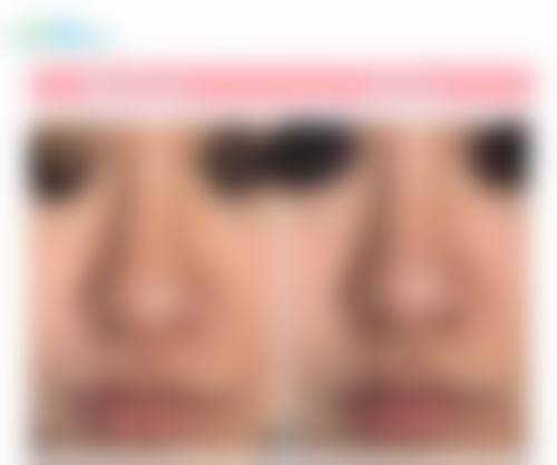 四、太原美客博仕医疗美容特色项目