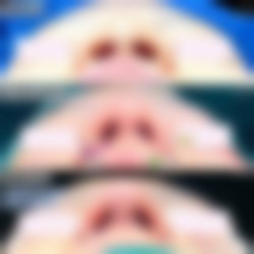 五、西安希颜医疗美容诊所价格表