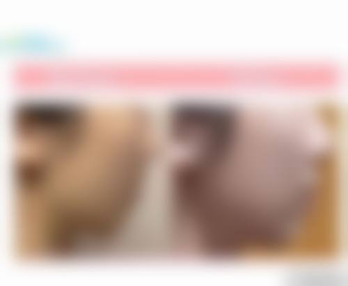 八、沧州水芙蓉医疗美容诊所预约方式