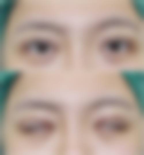 二、泸州悦她婕熹卡整形医院怎么样?