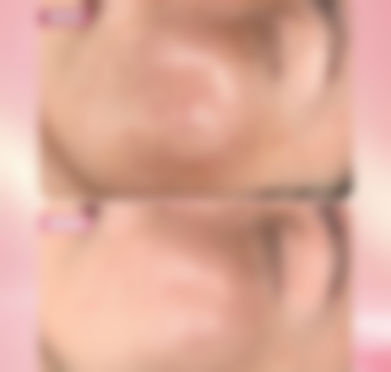 六、实用消肿图片参考