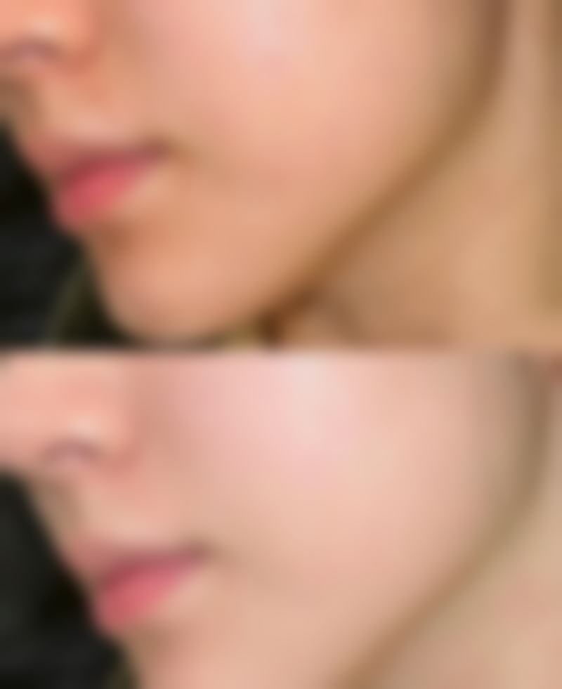 九、呼和浩特科益人医疗美容诊所真实的患者评价