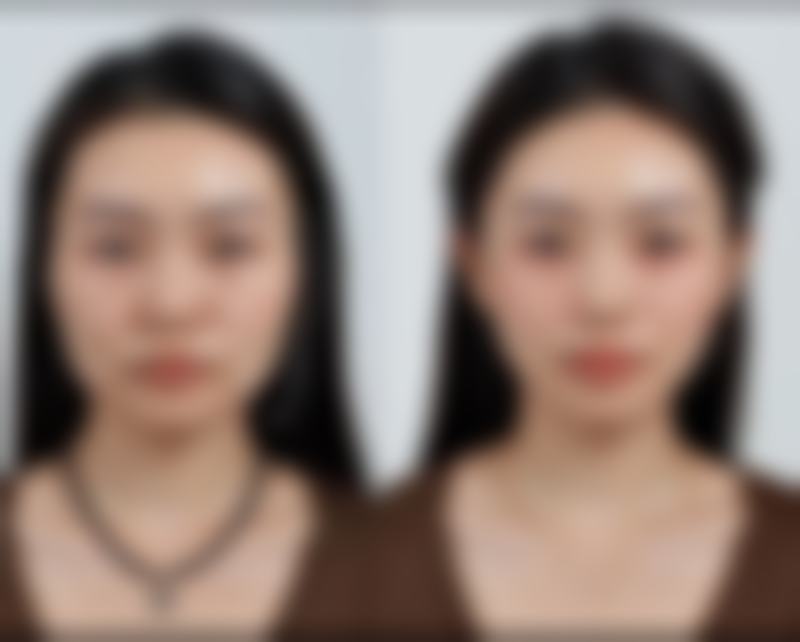 三、西安诺颜整形医疗美容医院诊疗项目有哪些？