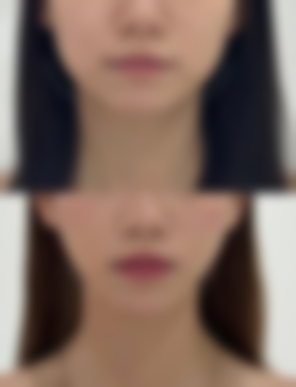 七、日常护理的重要性