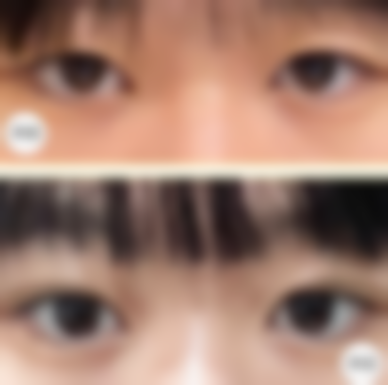 四、桂平市人民医院(烧伤整形外科)特色项目