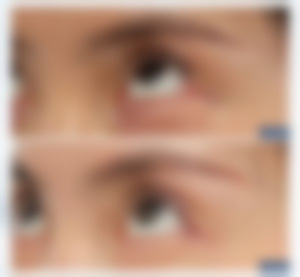 上海爱尚丽格医疗美容门诊部王衡健会不会亲自做手术？经验技术双优值得信任 