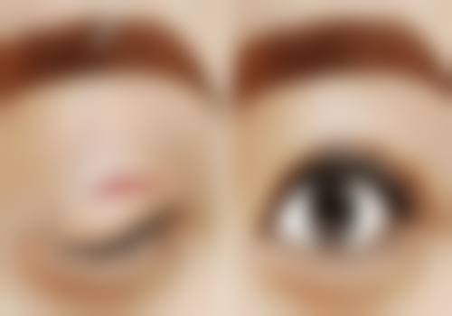 三、成都市西区医院整形美容诊疗项目有哪些?