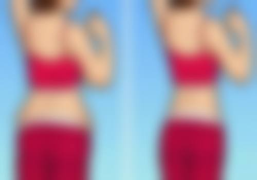 下巴整形哪种方法好一点？再次强调