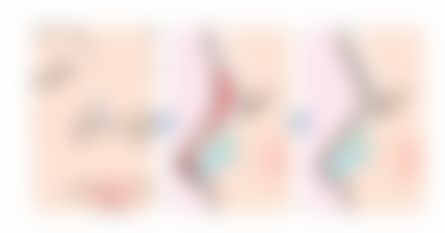 五、toxsta瘦脸针的安心性探讨