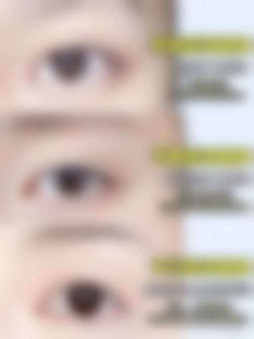 三、沈阳绣美倾城医疗美容诊疗项目有哪些?