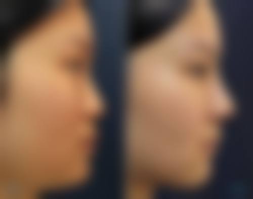 四、北京中豪医疗美容门诊部特色项目