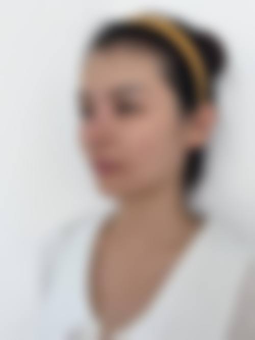 二、菏泽雅致医疗美容诊所怎么样？