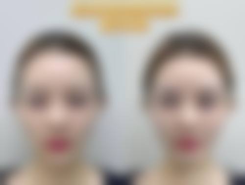 八、牡丹江北方工具厂职工医院真实的患者评价