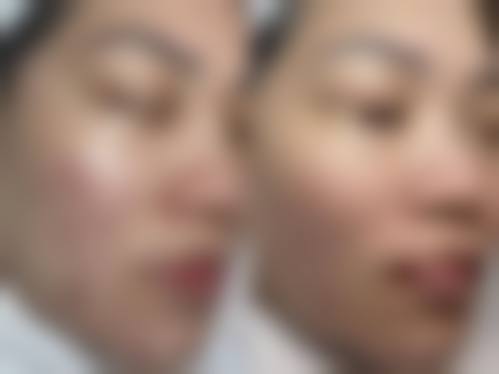 四、哈尔滨凯丽医疗美容门诊部特色项目