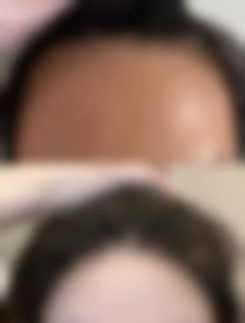 四、北京羽莎医疗美容特色项目