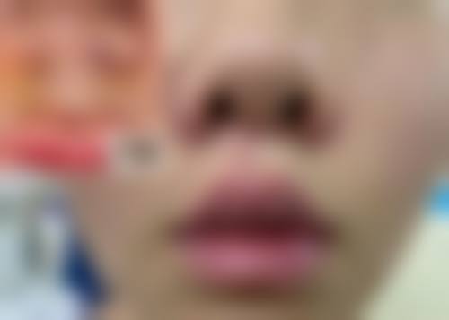 六、深圳康盈美华整形医学门诊部价格表