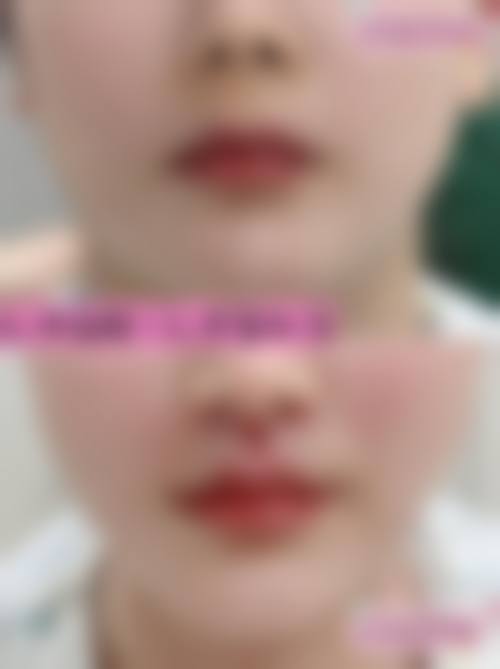 二、深圳康盈美华整形医学门诊部怎么样？