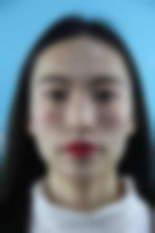 一、沈阳汇美人医疗美容诊所正规吗?