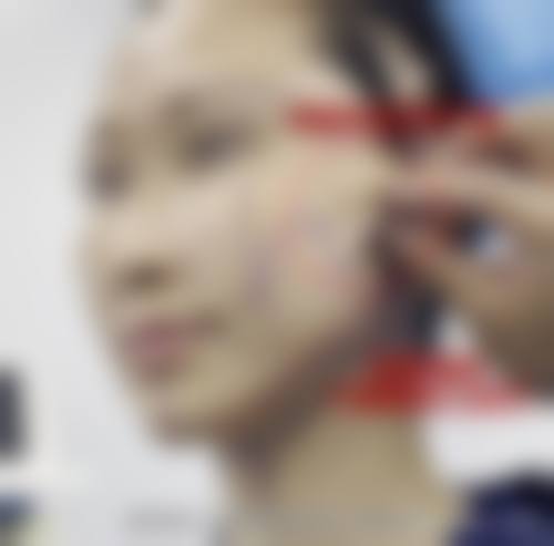 三、岳阳市非常好人民医院烧伤整形美容科诊疗项目有哪些?