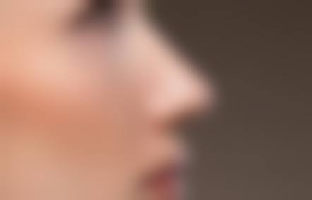 四、沈阳绣美倾城医疗美容特色项目