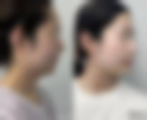 九、岳阳市非常好人民医院烧伤整形美容科真实的患者评价