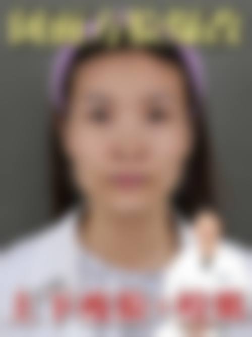 二、岳阳市非常好人民医院烧伤整形美容科怎么样?