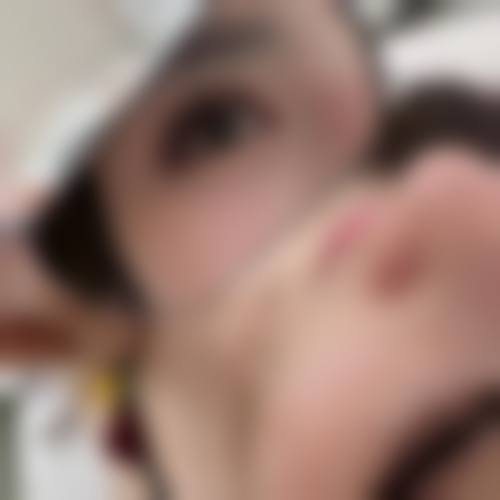 四、岳阳市非常好人民医院烧伤整形美容科特色项目