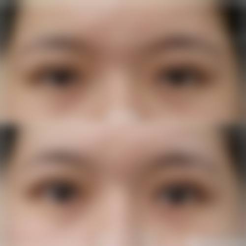 九、沈阳汇美人医疗美容诊所真实的患者评价