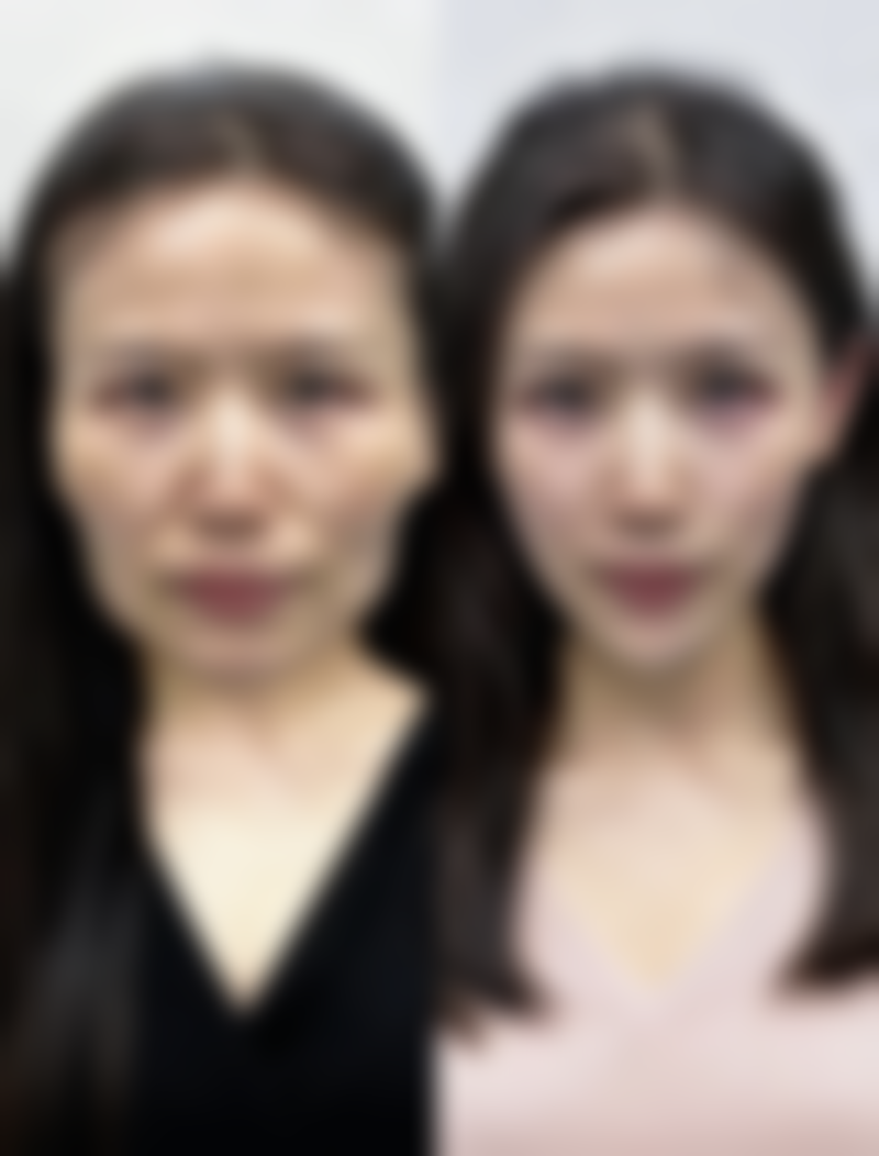 八、扬州艾菲斯医疗美容诊所预约方式