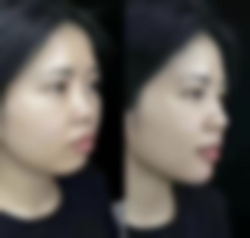 九、上海轻熙医疗美容门诊部真实的患者评价