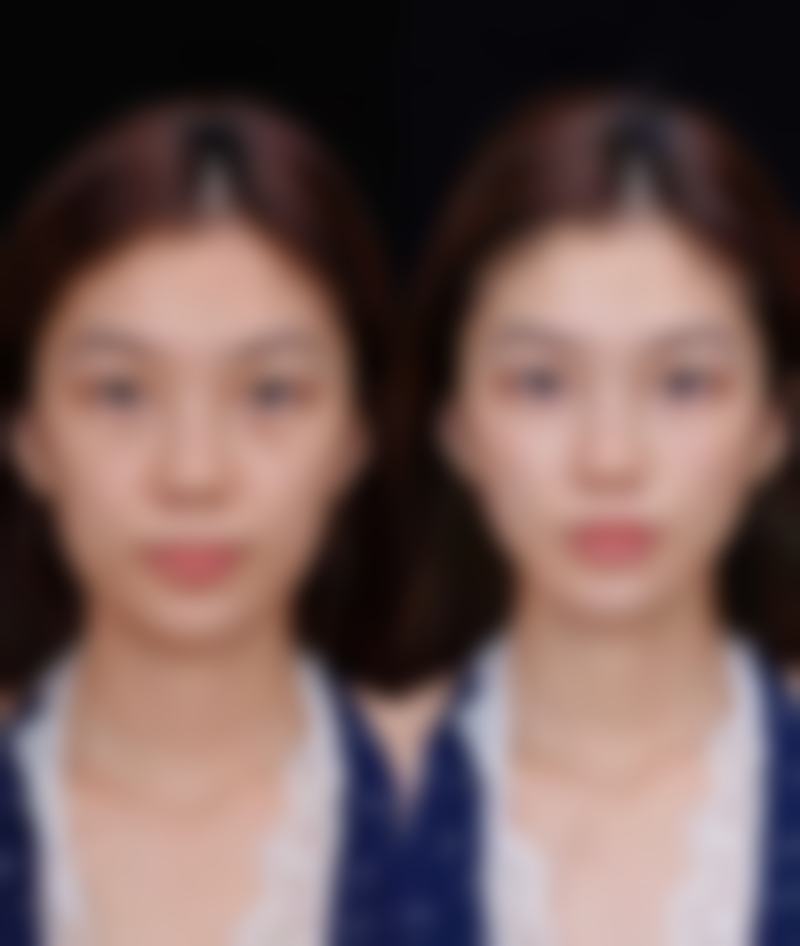 三、上海轻熙医疗美容门诊部诊疗项目有哪些?