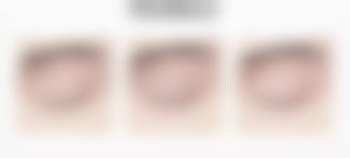 八、汕尾市人民医院烧伤整形科真实的患者评价