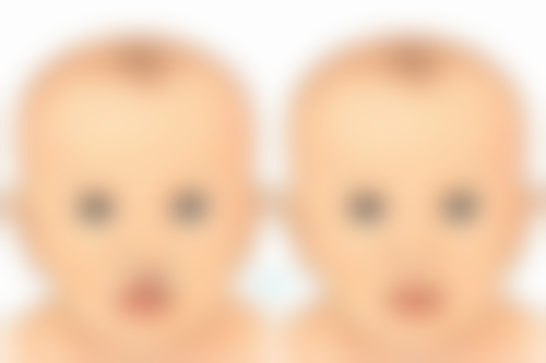 {隆鼻山根起点在哪？揭秘隆鼻山根从哪个部位起点及美学标准与手术考量