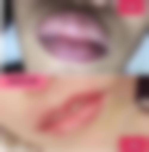 八、哪些人不适合打瘦脸针